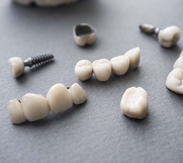 Van Nuys The Difference Between Dental Implants and Mini Dental Implants