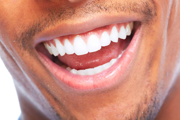 Are Professional Teeth Whitening Active  Ingredients Stronger?